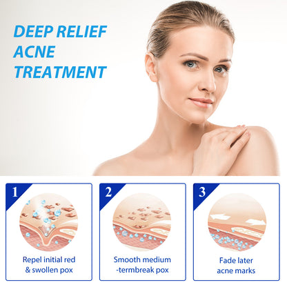 Lotion réparatrice d’acné EELHOE vitamines B3 et B5